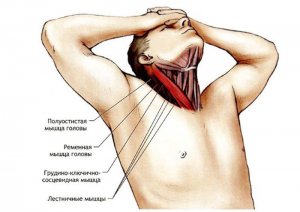 Лечение синдрома скованной шеи: постизометрическая релаксация