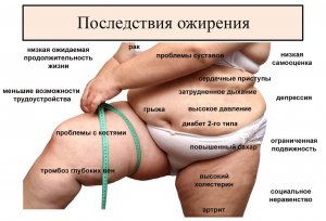 Причины увеличения веса