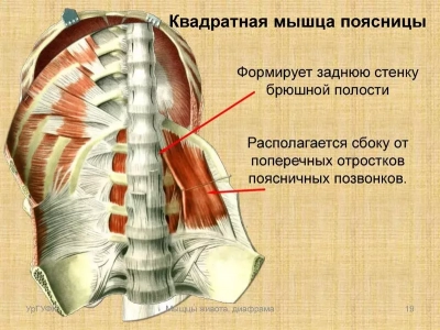 Синдром квадратной мышцы поясницы