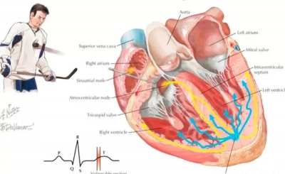 Commotio Cordis (сотрясение сердца)