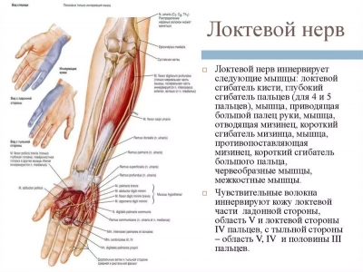Локтевой туннельный синдром
