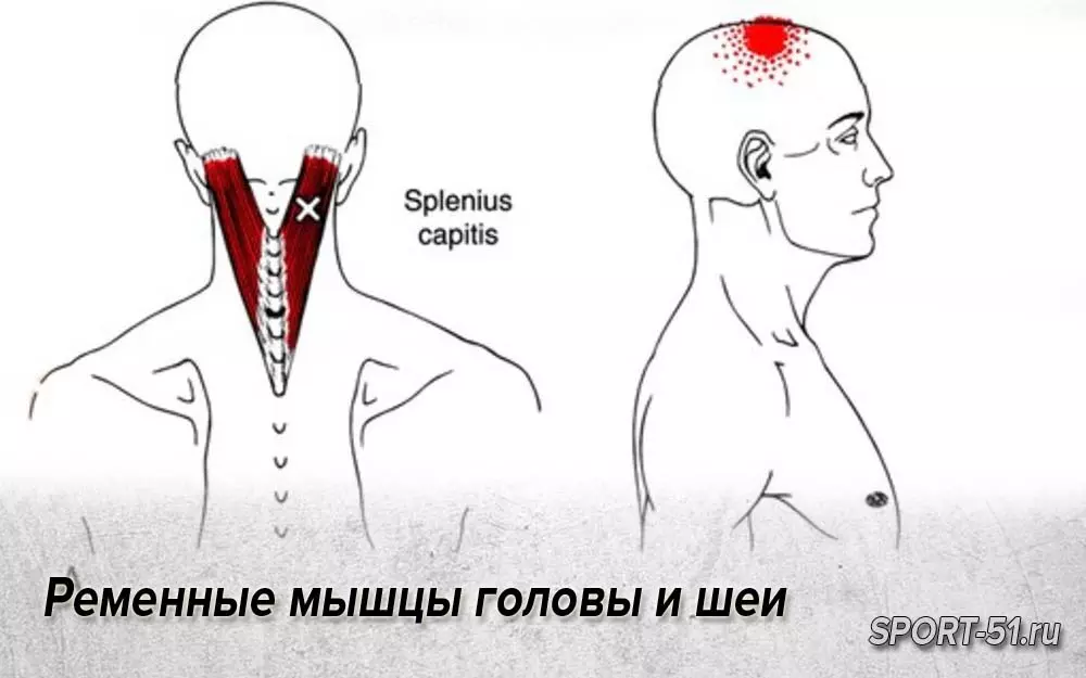 Болит голова и мышцы шеи. Ременная мышца головы триггерные точки. Ременная мышца шеи триггерные точки. Ременная мышца головы и шеи. Ременная мышца головы и шеи болит.