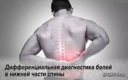 Дифференциальная диагностика болей в нижней части спины