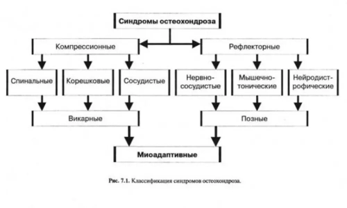 Миоадаптивные синдромы