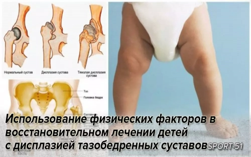 Использование физических факторов в восстановительном лечении детей с дисплазией тазобедренных суставов