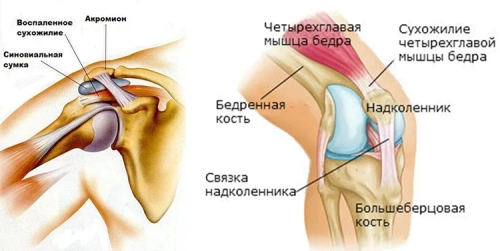 Как укрепить сухожилия и связки