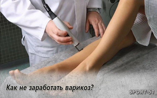 Как не заработать варикоз?